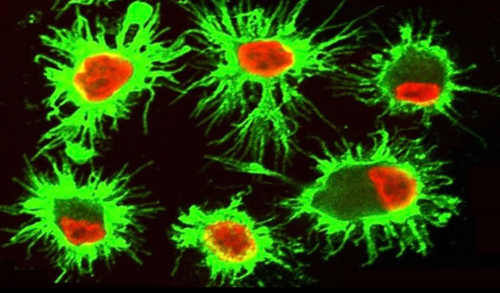 Las células dendríticas son las encargadas de activar la respuesta inmune para proteger al organismo de microorganismos y del cáncer. / CONICET.