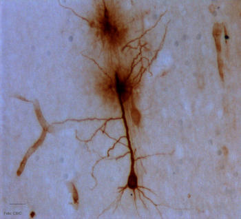 Neurona piramidal de la corteza somatosensorial de una rata que ha recibido una estimulación del nervio ciático en su pata posterior, de manera que esta parte del cerebro se activa. La neurona aparece oscura porque está capturando IGF-I sanguíneo.
