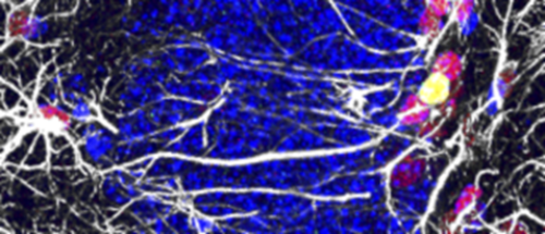 Células madre neurales en rojo y las activas, en amarillo. /CSIC.