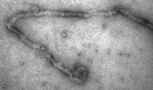 Detección mediante microscopía electrónica de partículas virales semejantes al virus del Ébola. / CSIC.