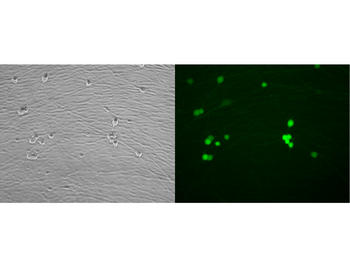A la izquierda, neuronas sensoriales de rata en cultivo observadas en campo claro. A la derecha, las mismas neuronas en las que se ve la proteina verde fluorescente (GFP) que se ha introducido. Imagen: J. C. Arévalo.