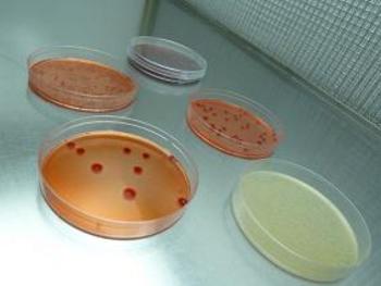 Cultivos bacterianos (Fotografía: Infouniversidades)