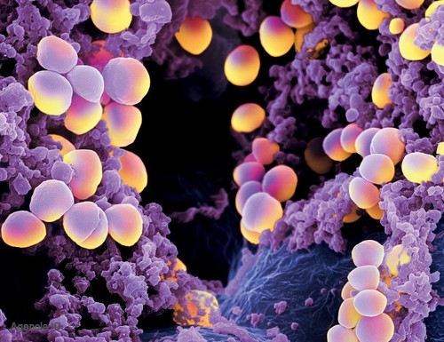 Bacteria Staphylococcus Aureus