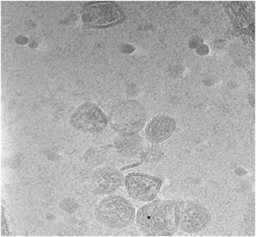 Exosomas presentes en líquido hidatídico fértil ovino. Imagen: IRNASA.