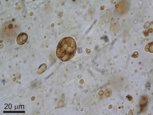 Gotas de savia elaborada de un cuarto del grosor de un cabello conservadas en ámbar de hace 105 millones de años. (Autor: Museo Geominero).