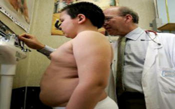 Obesidad infantil FOTO: MINSA.