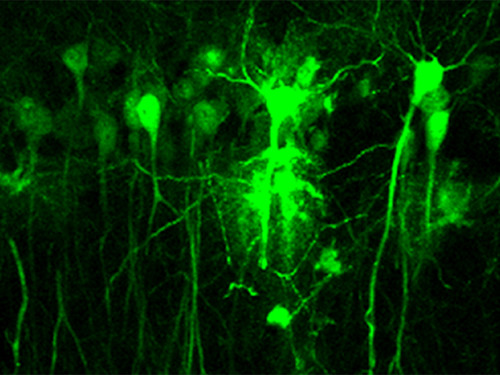 Neuronas hipocampales infectadas con partículas lentivirales que expresan la proteína verde fluorescente para la inactivación del receptor de dopamina D2. / CSIC.