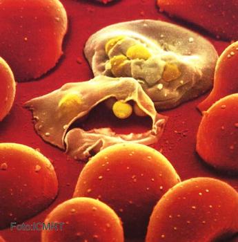 Los merozoitos (células hepáticas infectadas de malaria) entran en el torrente sanguíneo
