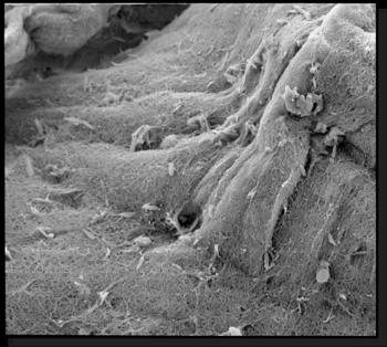 Osteoblastos colocados sobre un andamio de plasma, observados con microscopía electrónica de barrido. Foto: UNAM.
