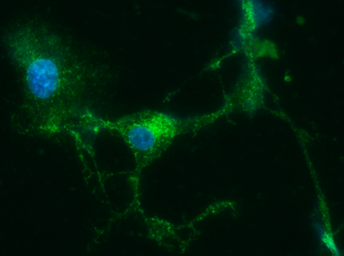 Células infectadas por el virus Mayaro/Choi, et al. (CC BY 4.0, 2018)