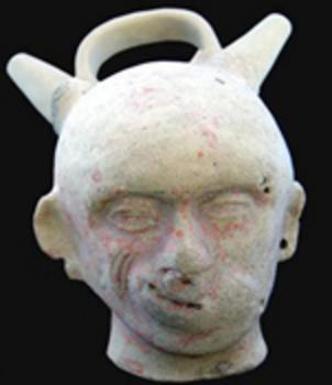 Figura que representa a un hombre con parálisis facial periférica (FOTO: AUPEC).