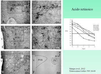 Imágenes de varias localizaciones de ácido retinoico en el sistema nervioso central. Imagen: Rafael Coveñas.
