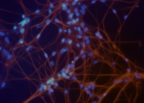Neuronas derivadas de células madre pluripotentes (núcleos en azul). FOTO: AGENCIA FAPESP