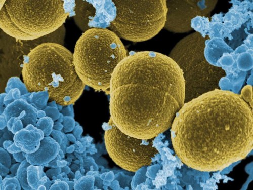Staphylococcus aureus.