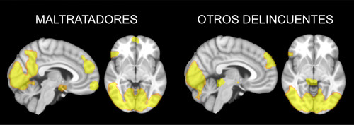 Diferencias entre cerebros. Imagen: UGR.
