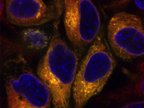 La enzima TMEM189 en el reticulo endoplasmático de las células humanas. / Universidad de Murcia.