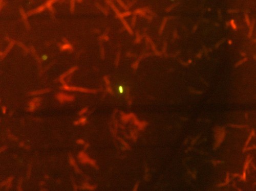 Imagen de microscopía de bacterias vivas (verde) en una muestra de bilis humana. / CSIC-IPLA.