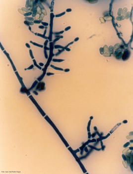 'Trichoderma longibrachiatum' observada al microscopio.