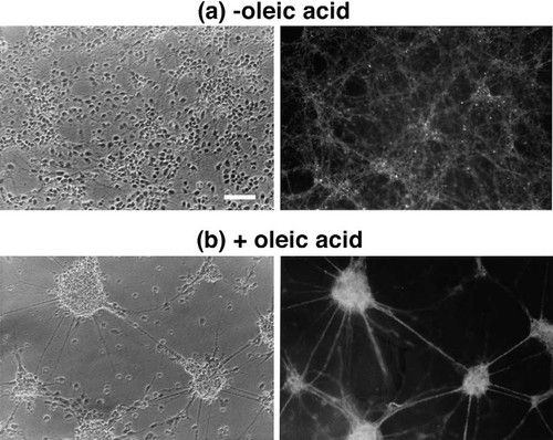 Diferencias entre las conexiones que establecen las neuronas con y sin ácido oleico. Imagen: J. M. Medina.