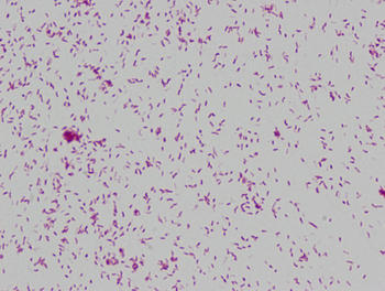Muestra microscópica del agente causal de la tuberculosis: Mycobacterium tuberculosis