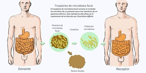 Trasplante de microbiota fecal. Imagen: CSIC.