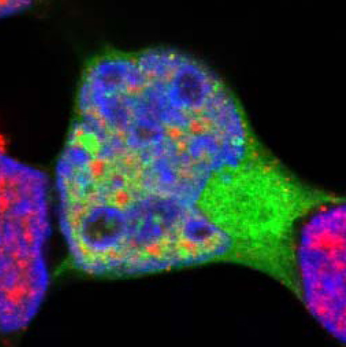 Imagen del gen MGRN1/Mahogunin secuestrado en el núcleo de la célula./CSIC.
