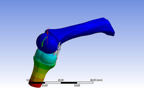Diseño de prótesis de falange hecho a la medida. FOTO: UN