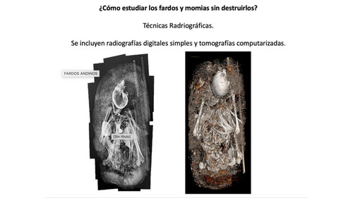 Parte de una presentación donde se observan las diferencias de las imágenes que se obtienen de los fardos a través de una radiografía (izq.) y una tomografía (der). Ambas técnicas permiten estudiar y preservar el contexto funerario.