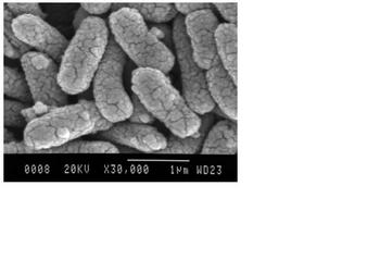 Imagen al microscopio electrónico de Escherichia coli. Fuente: L. R.