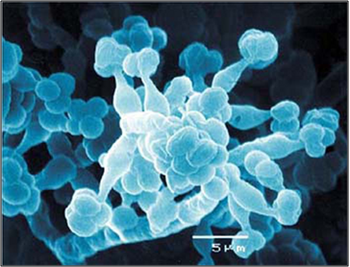 Imagen al microscopio del hongo 'Trichoderma'. Foto: Enrique Monte.