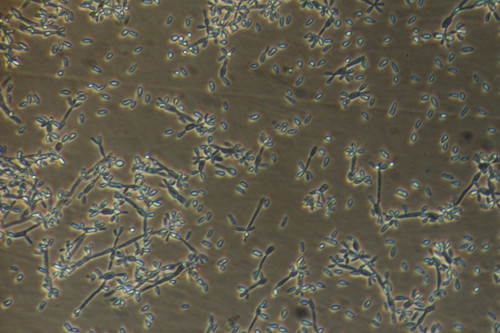 Vista microscópica de levaduras del hongo Sporothrix Schenkii Fotos Marie Fuzeau