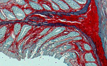 Histología de un colon de rata mostrando la fibrosis en una tinción en rojo. Foto: María Jesús Tuñón.