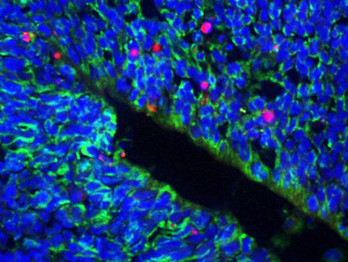 Corteza de embrión de ratón KO de Cdh1. En azul, núcleos de las células. En verde, las células positivas para Nestina (marcador de precursores neuronales). En rosa, células con Caspasa 3 activa (marcador de muerte celular). Imagen: CSIC.