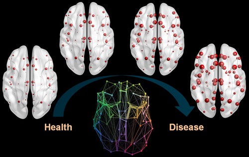 El cerebro va acumulando proteínas mal plegadas que se propagan de acuerdo con las conexiones nerviosas. Imagen: Iturria-Medina et al.