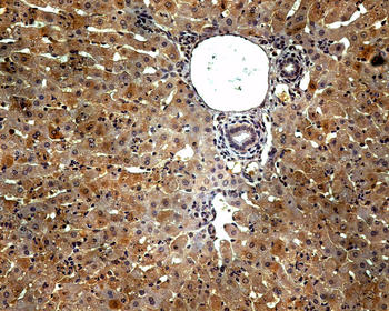 Expresión por inmunohistoquímica del factor Nrf2 (células de color marrón) en el hígado de animales con fallo hepático fulminante.