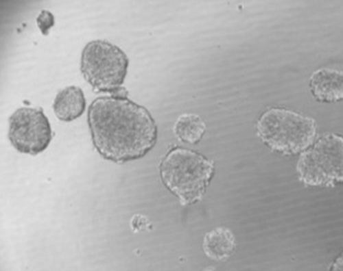 Células madre cancerígenas. Imagen: UGR.