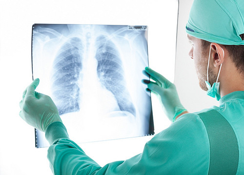 Radiografía de los pulmones.