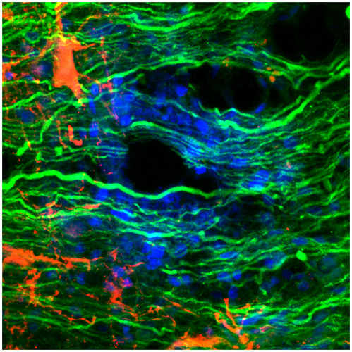 En verde se observan a los axones regenerados por efecto de la inyección de la proteína netrina-1 en los modelos animales de investigación, en rojo aparecen los astrocitos (células de soporte trófico y metabólico) y en azul los núcleos celulares.