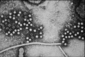 Imagen del virus de la hepatitis de tipo e-1, cuya presencia en la cadena alimentaria se caracterizará junto a otros virus. 