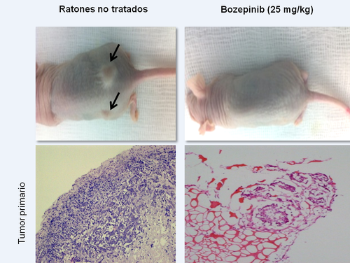 Cortes histológicos de un tumor primario antes y después de ser tratado con Bozepinib. Imágenes: UGR.