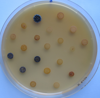 Diversidad que puede mostrar la bacteria Micromonospora. Foto: Pilar Martínez Hidalgo.