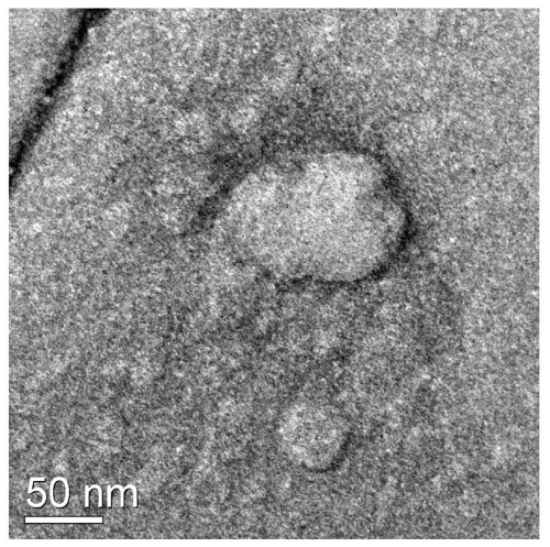 Imagem de microscopia eletrônica de transmissão vesículas extracelulares da saliva. Crédito: LNBio/CNPEM