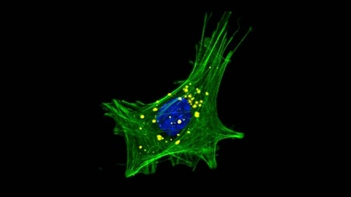 Agregados de α-sinucleína en células intestinales/Matheus de Castro Fonseca/CNPEM