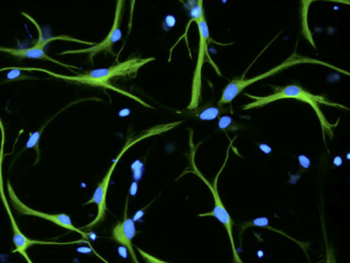 Astrocitos derivados de células madre neurales./Imagen cedida por las investigadoras.