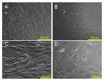 Diferentes aspectos de las células madre mesenquimales. Foto: Laboratorio de Terapia Celular del Hospital Universitario de Salamanca.