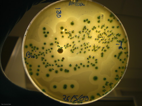Crecimiento de 'Listeria monocytogenes' en placa de ALOA.