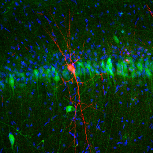 Neurona. Imagen: CSIC.
