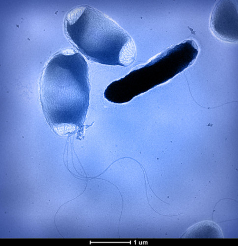 Imagen cortesía de la Unidad de Microscopía Electrónica - Ivic