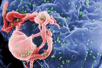 Microfotografía con MEB de VIH-1 en liberación (en verde) en un cultivo de linfocitos (FOTO: CDC). 