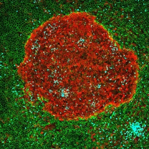 Agregado multicelular en la cavidad peritoneal tras 4 horas de infección con E. coli (macrófagos en rojo, neutrófilos en azul y células mesoteliales en verde). / Carlos Ardavín, CNB-CSIC.